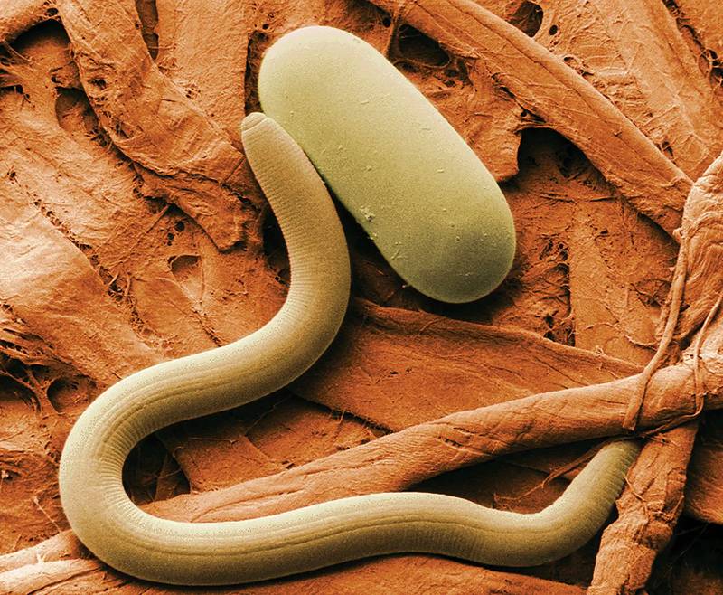 The soybean cyst nematode is a plant-parasitic roundworm. Laboratory testing is required to identify both the nematode and the scale of the infestation.
