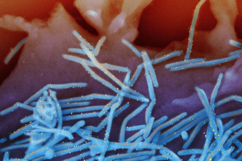 This electron microscope image provided by the National Institutes of Health shows human respiratory syncytial virus virions, colorized blue, and anti-RSV F protein/gold antibodies, colorized yellow, shedding from the surface of human lung cells. Americans 60 and older can get a new RSV vaccine, but should discuss it with their doctor first, U.S. health officials recommend.