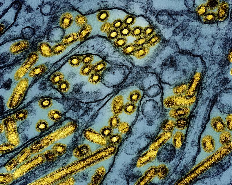 This colorized electron microscope image released by the National Institute of Allergy and Infectious Diseases shows avian influenza A H5N1 virus particles (yellow), grown in Madin-Darby Canine Kidney epithelial cells (blue).