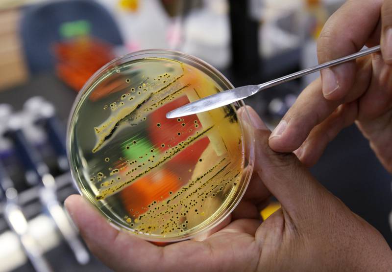 Salmonella grows in a petri dish being held by a researcher in a lab.