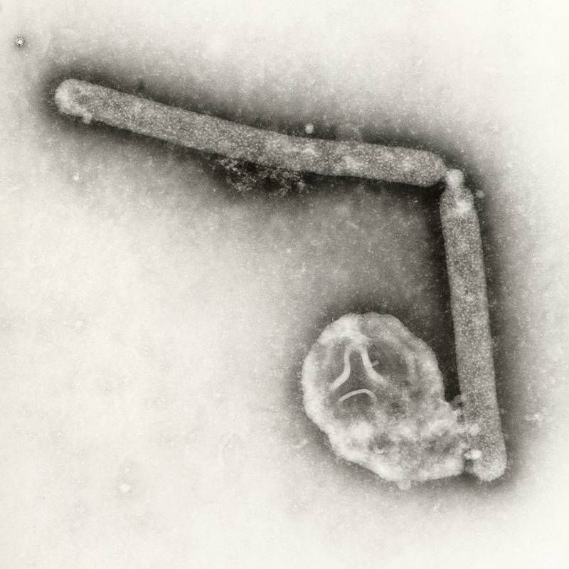 This electron microscopic image provided by the Centers for Disease Control and Prevention shows two Influenza A(H5N1) virions, a type of bird flu virus.