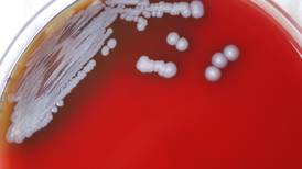 Bacteria that causes rare tropical disease found in U.S. soil